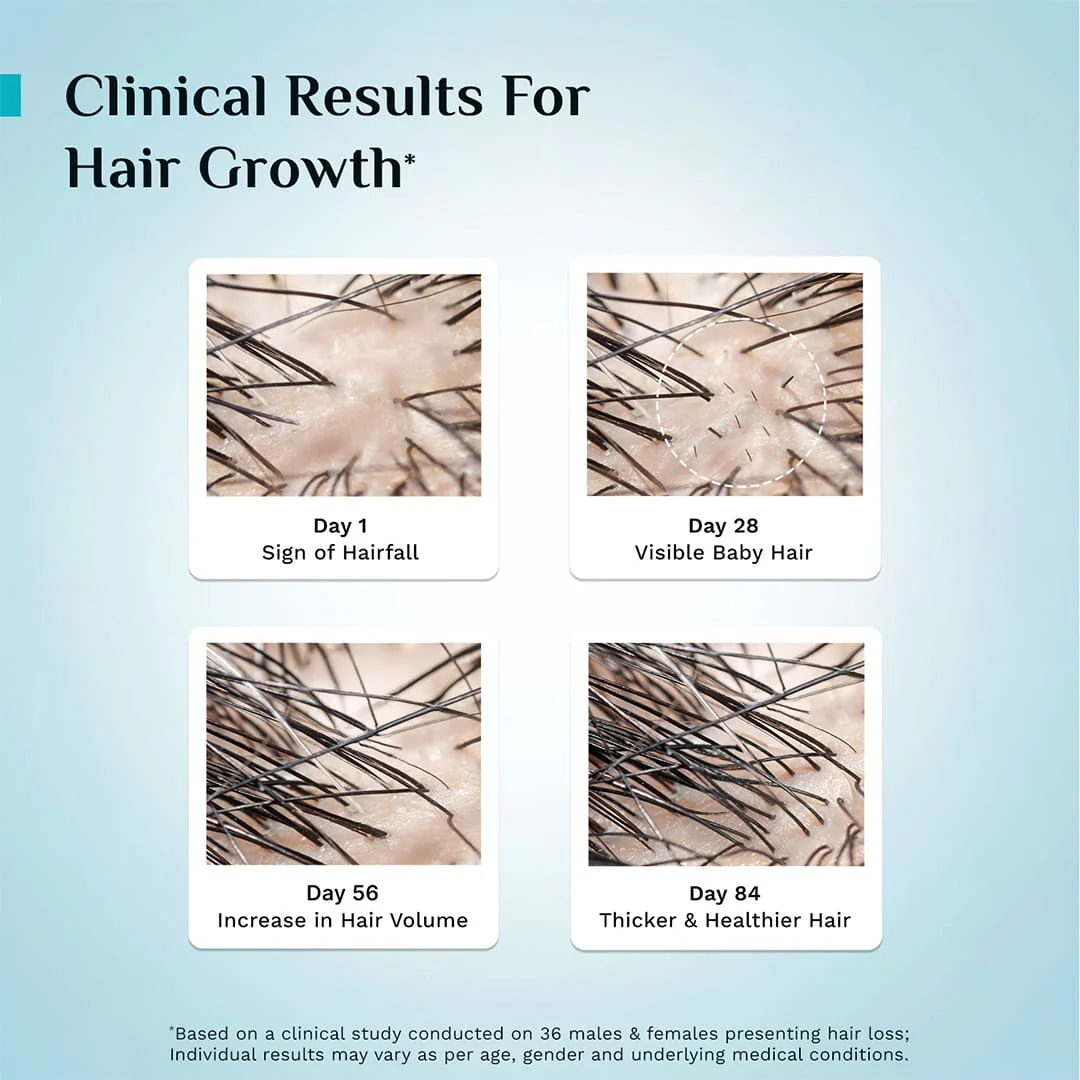 3% Redensyl, 4% Anagain & 5% Capilia Stem Cell Complex Advanced Hair Growth Serum - 50ml - Image 10