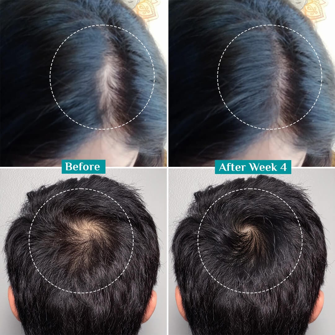 3% Redensyl, 4% Anagain & 5% Capilia Stem Cell Complex Advanced Hair Growth Serum Roll-On - Image 7