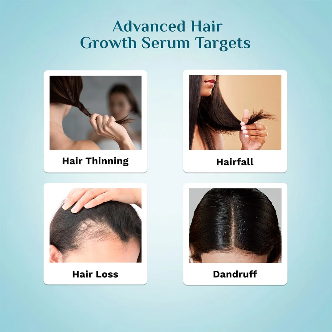 3% Redensyl & 4% Anagain Advanced Hair Growth Serum For Dandruff-Prone Scalp - 30 ml - Image 5